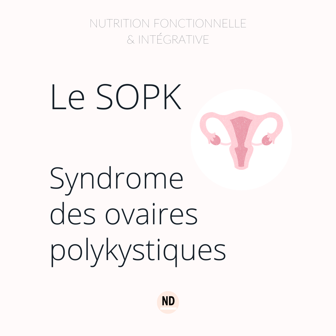 SOPK : la nutrition fonctionnelle dans le soin - Nathalie Deckert
